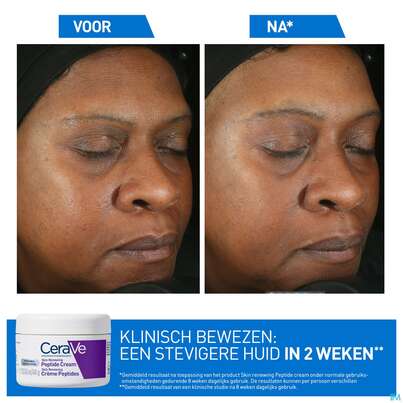Sie sehen eine Packung Cerave Skin Renewing Peptide Cr 48ml, Produktbild: 11 Cerave Skin Renewing Peptide Cr 48ml, A-Nr.: 5985696 - 11