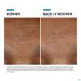 Sie sehen eine Packung Skinceuticals H.a. Intensifier Multi-glycan 30ml, Produktbild: 09 Skinceuticals H.a. Intensifier Multi-glycan 30ml, A-Nr.: 5896716 - 09