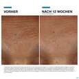 Sie sehen eine Packung Skinceuticals H.a. Intensifier Multi-glycan 30ml, Produktbild: 10 Skinceuticals H.a. Intensifier Multi-glycan 30ml, A-Nr.: 5896716 - 10