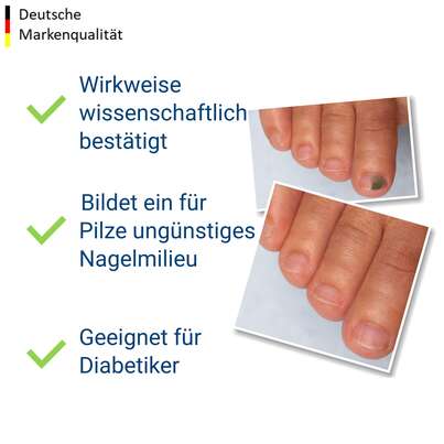 Sie sehen eine Packung Evolsin Anti-Nagelpilz liquid 10 ml, Produktbild: 03 Evolsin Anti-Nagelpilz liquid 10 ml, A-Nr.: 5666169 - 03